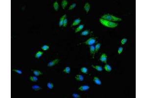 Immunofluorescent analysis of Hela cells using ABIN7145766 at dilution of 1:100 and Alexa Fluor 488-congugated AffiniPure Goat Anti-Rabbit IgG(H+L)