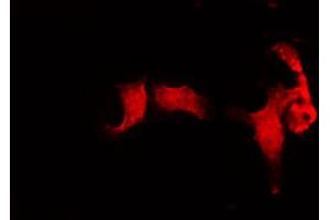 ABIN6272272 staining HuvEc by IF/ICC.