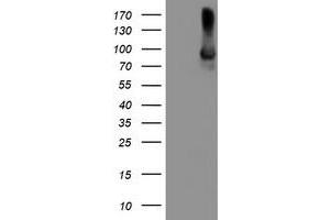 Western Blotting (WB) image for anti-Arachidonate 15-Lipoxygenase (ALOX15) antibody (ABIN1496358) (ALOX15 anticorps)