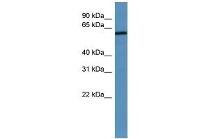 WB Suggested Anti-MAGED2 Antibody Titration: 0. (MAGED2 anticorps  (N-Term))