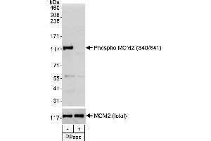 Western Blotting (WB) image for anti-Minichromosome Maintenance Complex Component 2 (MCM2) (pSer40), (pSer41) antibody (ABIN7449413)