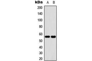 Western blot analysis of Cytochrome P450 2C19 expression in HeLa (A), human liver (B) whole cell lysates. (CYP2C19 anticorps  (Center))
