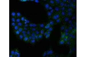 IF analysis of Bcr using anti-Bcr antibody (ABIN4886483). (BCR anticorps  (AA 1-100))