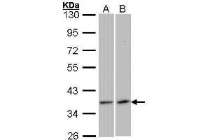 WB Image Sample (30 ug of whole cell lysate) A: 293T B: Raji 10% SDS PAGE antibody diluted at 1:1000 (VEGFD anticorps)