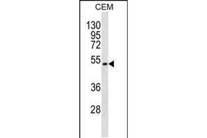 Western blot analysis in CEM cell line lysates (35ug/lane). (TOM1L2 anticorps  (C-Term))
