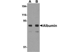 Western blot analysis of Albumin in mouse liver tissue lysate with Albumin antibody at (A) 1 and (B) 2 μg/ml. (Albumin anticorps  (Center))