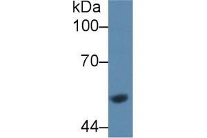 Western Blot; Sample: Rat Liver lysate; Primary Ab: 1µg/ml Rabbit Anti-Rat GCK Antibody Second Ab: 0. (GCK anticorps  (AA 194-410))