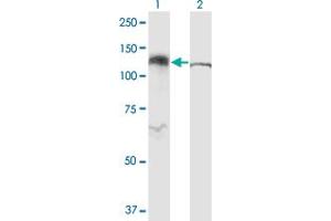 Western Blot analysis of IPO5 expression in transfected 293T cell line by RANBP5 monoclonal antibody (M01), clone 1C4.