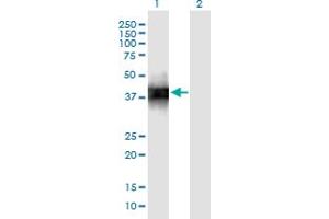 Western Blot analysis of SFTPB expression in transfected 293T cell line by SFTPB monoclonal antibody (M01), clone 1H7. (SFTPB anticorps  (AA 1-381))
