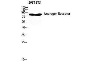Western Blotting (WB) image for anti-Androgen Receptor (AR) (Ser154) antibody (ABIN3173851) (Androgen Receptor anticorps  (Ser154))