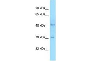 Image no. 1 for anti-UDP-Gal:betaGlcNAc beta 1,4- Galactosyltransferase, Polypeptide 3 (B4GALT3) (C-Term) antibody (ABIN6748337)