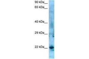 Image no. 1 for anti-Synovial Sarcoma, X Breakpoint 5 (SSX5) (AA 119-168) antibody (ABIN6748426) (SSX5 anticorps  (AA 119-168))