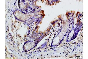 Formalin-fixed and paraffin embedded mouse intestine labeled with Anti-CCL19/MIP-3 beta Polyclonal Antibody, Unconjugated (ABIN740505) at 1:200 followed by conjugation to the secondary antibody and DAB staining