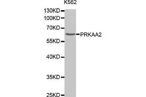 Western Blotting (WB) image for anti-Protein Kinase, AMP-Activated, alpha 2 Catalytic Subunit (PRKAA2) antibody (ABIN1678656) (PRKAA2 anticorps)
