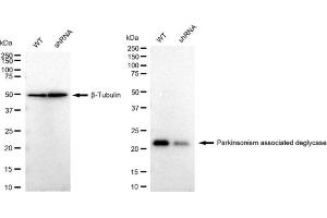 Western blotting analysis using Parkinsonism associated deglycase antibody (ABIN7800048). (Recombinant Protein/nucleic Acid Deglycase DJ-1 (PARK7) anticorps)