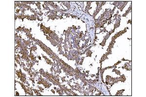 IHC analysis of LRP1B using anti-LRP1B antibody (ABIN7601521). (LRP1B anticorps  (AA 3704-4547))