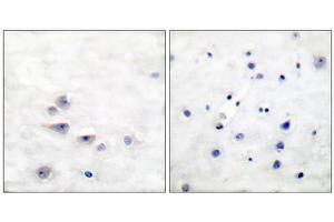 Immunohistochemical analysis of paraffin-embedded human brain tissue using Shc (phospho-Tyr427) antibody. (SHC1 anticorps  (pTyr427))
