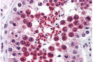 Human Testis (formalin-fixed, paraffin-embedded) stained with RTN4 antibody ABIN343915 at 3 ug/ml followed by biotinylated goat anti-rabbit IgG secondary antibody ABIN481713, alkaline phosphatase-streptavidin and chromogen. (Reticulon 4 anticorps  (Internal Region))