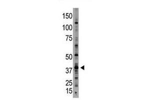 Image no. 1 for anti-Growth Differentiation Factor 1 (GDF1) (N-Term) antibody (ABIN357457) (GDF1 anticorps  (N-Term))