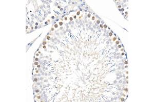 Immunohistochemistry of paraffin-embedded mouse lung using Phospho--S473 Rabbit mAb (ABIN6135179, ABIN6135970, ABIN6135971 and ABIN7101880) at dilution of 1:100 (40x lens). (AKT1 anticorps  (pSer473))