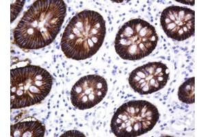 Image no. 2 for anti-Carbonic Anhydrase 12 (CA12) antibody (ABIN1497068)