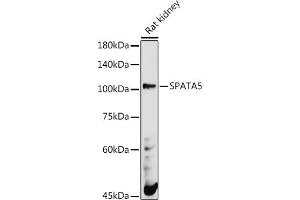 Western blot analysis of extracts of Rat kidney, using SP antibody (ABIN7270524) at 1:500 dilution. (SPATA5 anticorps)