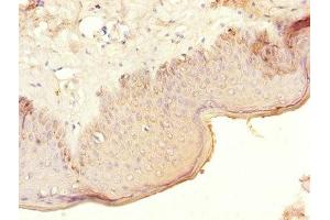 Immunohistochemistry of paraffin-embedded human skin tissue using ABIN7148625 at dilution of 1:100 (CRHR1 anticorps  (AA 24-121))