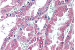 Human Kidney (formalin-fixed, paraffin-embedded) stained with COL18A1 antibody ABIN305768 at 10 ug/ml followed by biotinylated goat anti-rabbit IgG secondary antibody ABIN481713, alkaline phosphatase-streptavidin and chromogen. (COL18A1 anticorps  (C-Term))
