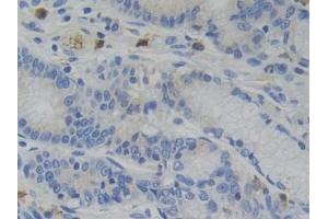 Detection of GR in Human Stomach Tissue using Polyclonal Antibody to Glucocorticoid Receptor (GR)