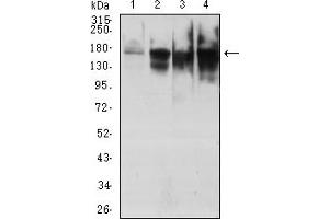 Western blot analysis using TOP2A mouse mAb against HepG2 (1), Hela (2), Jurkat (3), and K562 (4) cell lysate.