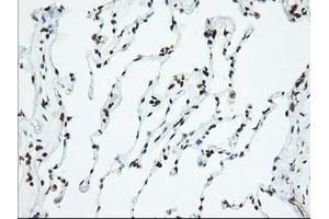 Image no. 3 for anti-Ubiquitin Specific Peptidase 5 (USP5) antibody (ABIN1501693)