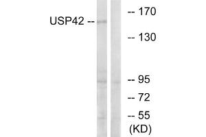 Western blot analysis of extracts from HT-29 cells, using USP42 antibody. (USP42 anticorps  (Internal Region))