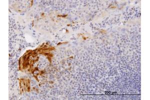 Immunoperoxidase of purified MaxPab antibody to S100A7 on formalin-fixed paraffin-embedded human tonsil.