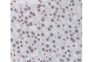 IHC-P analysis of liver tissue, with DAB staining. (NXF1 anticorps  (AA 2-197))