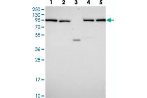 Western blot analysis of Lane 1: RT-4, Lane 2: U-251 MG, Lane 3: Human Plasma, Lane 4: Liver, Lane 5: Tonsil with INO80D polyclonal antibody . (IN80D anticorps)