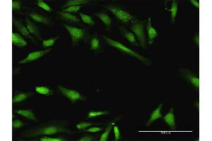 Immunofluorescence of purified MaxPab antibody to BIN1 on HeLa cell. (BIN1 anticorps  (AA 1-482))