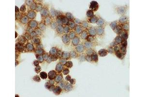 ICC testing of HNF6 antibody and HCT116 cells (ONECUT1 anticorps  (N-Term))