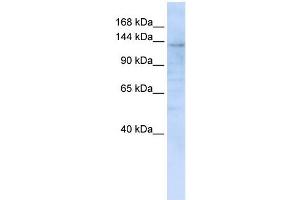 IMPG2 antibody used at 1 ug/ml to detect target protein.
