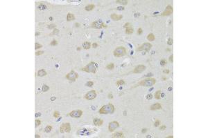 Immunohistochemistry of paraffin-embedded rat brain using DHRS9 Antibody (ABIN5973740) at dilution of 1/100 (40x lens). (DHRS9 anticorps)