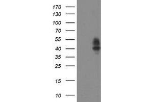 Western Blotting (WB) image for anti-Leucine Rich Repeat Containing 25 (LRRC25) antibody (ABIN1499201) (LRRC25 anticorps)