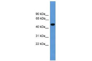 WB Suggested Anti-PSEN1 Antibody Titration: 0. (Presenilin 1 anticorps  (Middle Region))