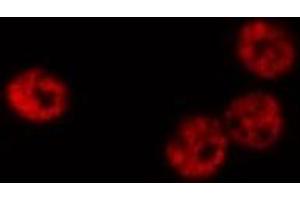 ABIN6268809 staining K-562 cells by IF/ICC. (HNRNPC anticorps  (C-Term))