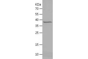 Western Blotting (WB) image for Heterogeneous Nuclear Ribonucleoprotein A2/B1 (HNRNPA2B1) (AA 1-249) protein (His tag) (ABIN7123320)