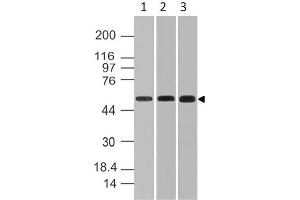 Image no. 1 for anti-RanBP-Type and C3HC4-Type Zinc Finger Containing 1 (RBCK1) (AA 121-333) antibody (ABIN5027252) (RBCK1 anticorps  (AA 121-333))