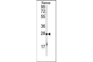 Western blot analysis of anti-CHIP (STUB1) Antibody (C-term) in Ramos cell line lysates (35ug/lane). (STUB1 anticorps  (C-Term))
