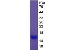 SDS-PAGE of Protein Standard from the Kit  (Highly purified E. (CEA Kit ELISA)