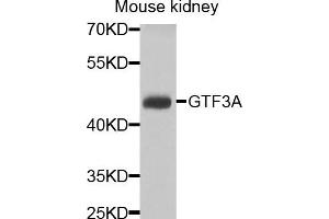 Western blot analysis of extracts of mouse kidney cells, using GTF3A antibody.