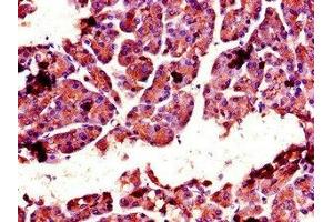 Immunohistochemistry of paraffin-embedded human pancreatic tissue using ABIN7147742 at dilution of 1:100 (Chymotrypsin anticorps  (AA 90-220))
