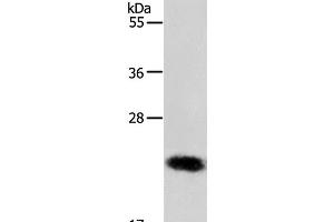 Western Blot analysis of MCF-7 cell using RAB22A Polyclonal Antibody at dilution of 1:650 (RAB22A anticorps)
