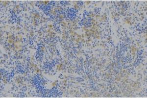 ABIN6277978 at 1/100 staining Human lymph node tissue by IHC-P.